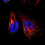 GOLPH2 Polyclonal Antibody