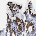 GOLPH2 Antibody in Immunohistochemistry (Paraffin) (IHC (P))