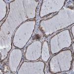 SIL1 Polyclonal Antibody