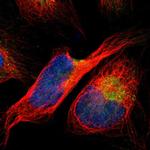 ACSL1 Polyclonal Antibody