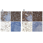 ACSL1 Antibody in Immunohistochemistry (Paraffin) (IHC (P))