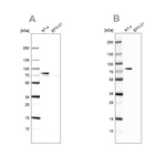 ACSL1 Antibody in Western Blot (WB)