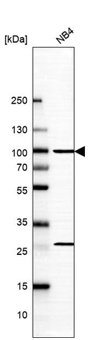 GCS1 Antibody in Western Blot (WB)
