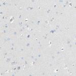 ACADL Antibody in Immunohistochemistry (Paraffin) (IHC (P))