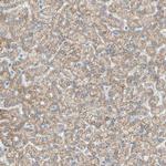 ACADL Antibody in Immunohistochemistry (Paraffin) (IHC (P))