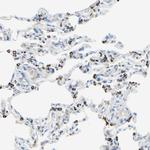 ACADL Polyclonal Antibody