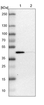 ACADL Antibody in Western Blot (WB)