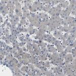 ErbB4 Polyclonal Antibody
