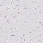 CES1 Antibody in Immunohistochemistry (Paraffin) (IHC (P))
