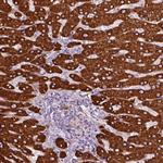 CES1 Antibody in Immunohistochemistry (Paraffin) (IHC (P))
