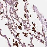 CES1 Antibody in Immunohistochemistry (Paraffin) (IHC (P))