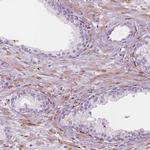 CES1 Antibody in Immunohistochemistry (Paraffin) (IHC (P))