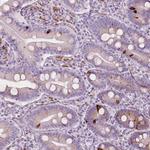 CES1 Antibody in Immunohistochemistry (Paraffin) (IHC (P))