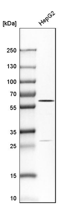 CES1 Antibody in Western Blot (WB)