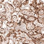 PARP14 Antibody in Immunohistochemistry (Paraffin) (IHC (P))