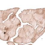 PARP14 Antibody in Immunohistochemistry (Paraffin) (IHC (P))