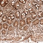 PARP14 Antibody in Immunohistochemistry (Paraffin) (IHC (P))