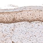 PARP14 Antibody in Immunohistochemistry (Paraffin) (IHC (P))