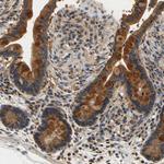 TNIK Antibody in Immunohistochemistry (Paraffin) (IHC (P))