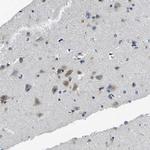 TNIK Antibody in Immunohistochemistry (Paraffin) (IHC (P))