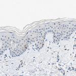 TNIK Antibody in Immunohistochemistry (Paraffin) (IHC (P))