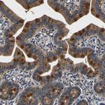 TNIK Antibody in Immunohistochemistry (Paraffin) (IHC (P))