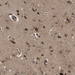 LRP4 Antibody in Immunohistochemistry (Paraffin) (IHC (P))