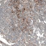 CSF1R Antibody in Immunohistochemistry (Paraffin) (IHC (P))