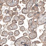CSF1R Antibody in Immunohistochemistry (Paraffin) (IHC (P))
