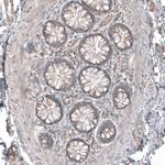 CSF1R Antibody in Immunohistochemistry (Paraffin) (IHC (P))