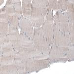 CSF1R Antibody in Immunohistochemistry (Paraffin) (IHC (P))