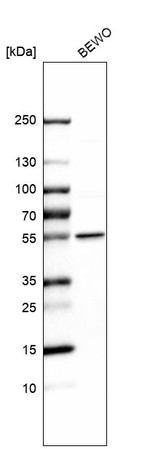 LPCAT1 Antibody in Western Blot (WB)