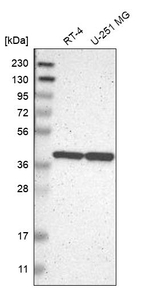 ENDOGL1 Antibody in Western Blot (WB)