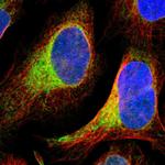 PTP1B Polyclonal Antibody