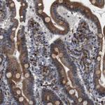 PTP1B Antibody in Immunohistochemistry (Paraffin) (IHC (P))
