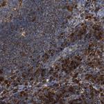 PTP1B Antibody in Immunohistochemistry (Paraffin) (IHC (P))