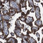 PTP1B Antibody in Immunohistochemistry (Paraffin) (IHC (P))