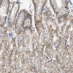 CD155 Antibody in Immunohistochemistry (Paraffin) (IHC (P))