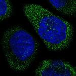 THSD1 Polyclonal Antibody