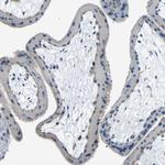 THSD1 Antibody in Immunohistochemistry (Paraffin) (IHC (P))