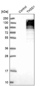 THSD1 Antibody in Western Blot (WB)