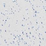 Desmocollin 2 Antibody in Immunohistochemistry (Paraffin) (IHC (P))