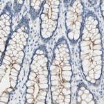 Desmocollin 2 Antibody in Immunohistochemistry (Paraffin) (IHC (P))