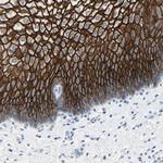 Desmocollin 2 Antibody in Immunohistochemistry (Paraffin) (IHC (P))