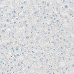 Desmocollin 2 Antibody in Immunohistochemistry (Paraffin) (IHC (P))
