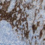 Desmocollin 2 Antibody in Immunohistochemistry (Paraffin) (IHC (P))