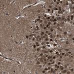 VCP Antibody in Immunohistochemistry (Paraffin) (IHC (P))