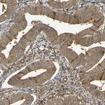 SERPINB6 Polyclonal Antibody
