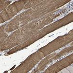 SERPINB6 Antibody in Immunohistochemistry (Paraffin) (IHC (P))