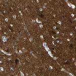 Calcineurin A Antibody in Immunohistochemistry (Paraffin) (IHC (P))